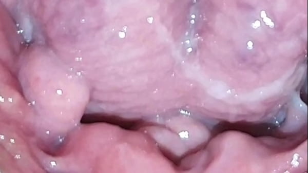 Image Gaping my fat and hairy pussy