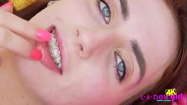 Image Beautiful 4K video of Teen with Braces