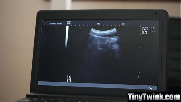 Image My Doctor's Cock Was Way Too Big to Swallow Completely - Tinytwink