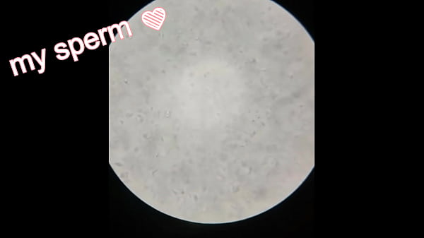 Image Sperm Observation 1 (No Abstinence)