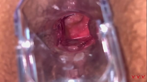 Image Anal Vision Speculum