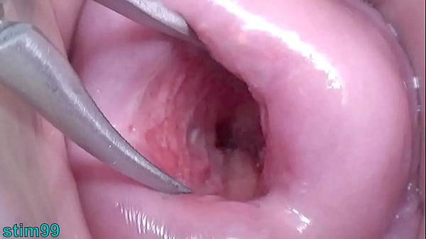 Image Japanese Wife Open Cervix Wide to watch inside Uterus
