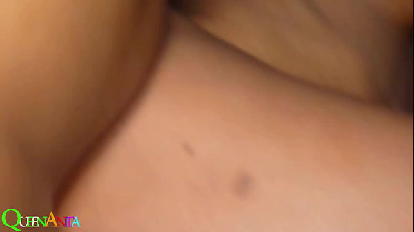 Image Why so changing different styles with some one hole