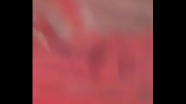 Image El tama&ntilde_o de ese cl&iacute_toris es normal?