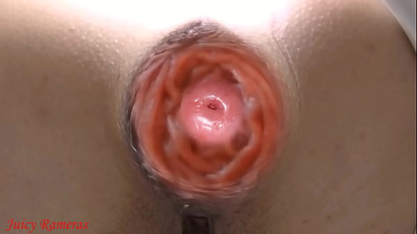 Image Anal slut lost her asshole prolapse while peeing in public toilet