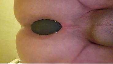 Image P&eacute_n&eacute_tration plug anal