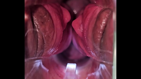 Image Speculum cervix play cumming