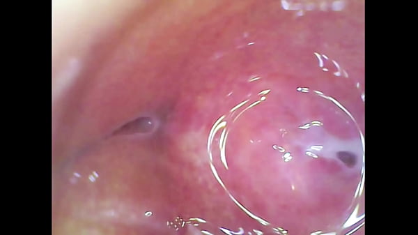 Image Real pussy orgasm contraction cam inside pussy!!! Sperm found in pussy juice under microscope!!!