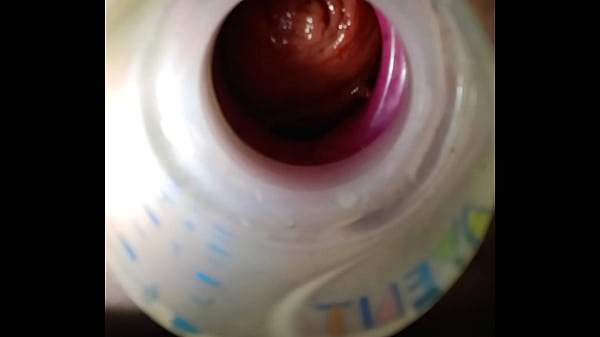 Image Anal gape and insertion