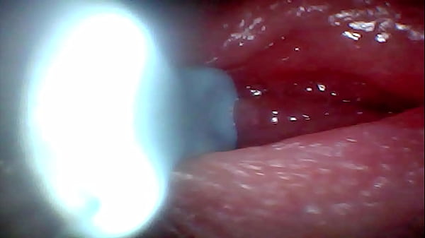 Image Endoscope camera captures moment of male ejaculation