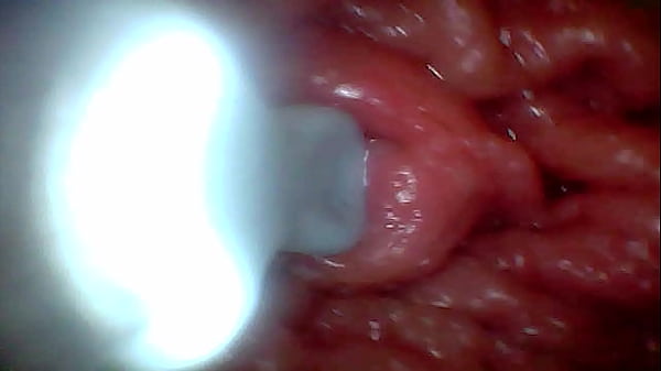 Image First time: An endoscope reveals the G-spot up close &ndash_ without mounting!