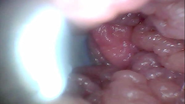 Image Endoscope camera shows the most sensitive parts of the penis Educational video