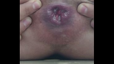 Image Entrenamiento anal