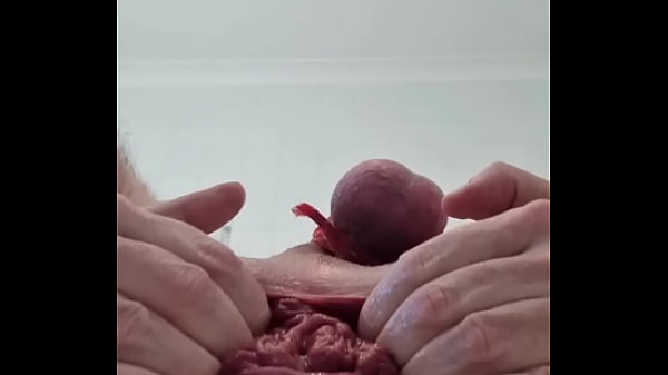 Image 2 plugs a dildo orange eggplant prolapse