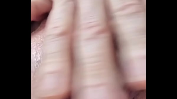 Image Prolapse play