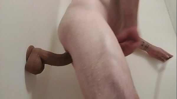 Image Prostate play