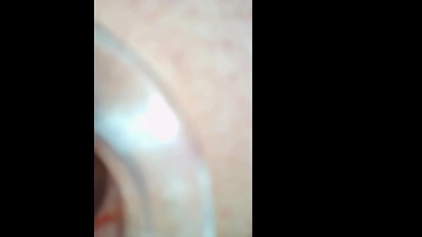 Image Preparing for extreme anal gape close up