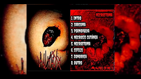 Image VulvaxXx - NecroStoma [FULL EP No.3] ( 2023 - Pornogoregrind)
