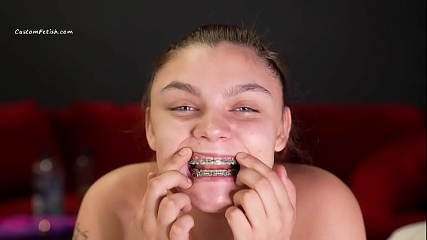 Image Model Shows Braces, Dick Rub on Braces, Pee in Braces Mouth