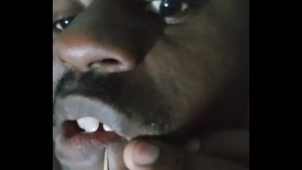 Image Privately showing other ways that I pop pimples for free whenever they develop 2