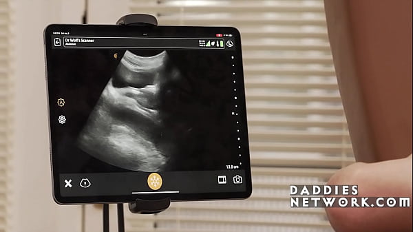 Image Doctor's Special Anal Ultrasound Dickment