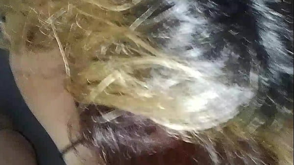 Image topou anal de primeira
