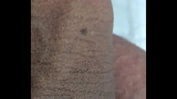 Image O QUE S&Atilde_O ESSAS MANCHAS EM MEU PENIS? UM CLOSE BEM DE PERTO