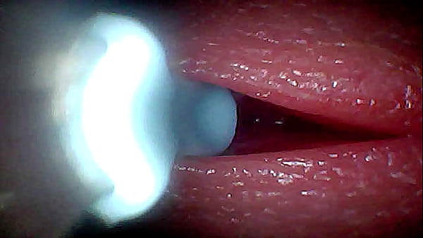 Image I couldn&rsquo_t believe what happens INSIDE the penis as sperm passes through (endoscopic footage)