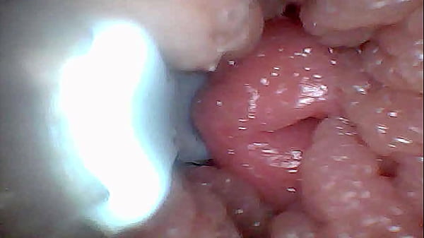 Image Visual Guide to G-Spot Stimulation and Orgasm &mdash_ Endoscop Perspective