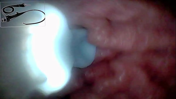 Image Exclusive: Camera Goes Inside &ndash_ We Found My G-Spot and Captured 5 Orgasms!