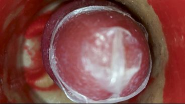 Image The camera inside the deep pussy records a huge ejaculation with a stuck condom