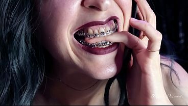 Image Biting my own fingers - bite, mouth, teeth, braces, fetish ITA