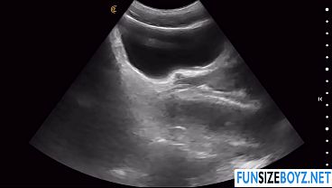 Image While having an ultrasound my doctor penetrates me