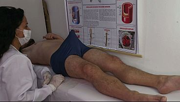 Image Nurse Observes Patient's Erection