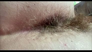 Image Hairy Ass Fetish