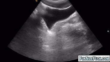Image ULTRA SCAN revealed a HUGE Secret Hidden in His Belly! Grayson Cole examination of his colon by Legrand Wolf turned out to be an experience he would never forget!